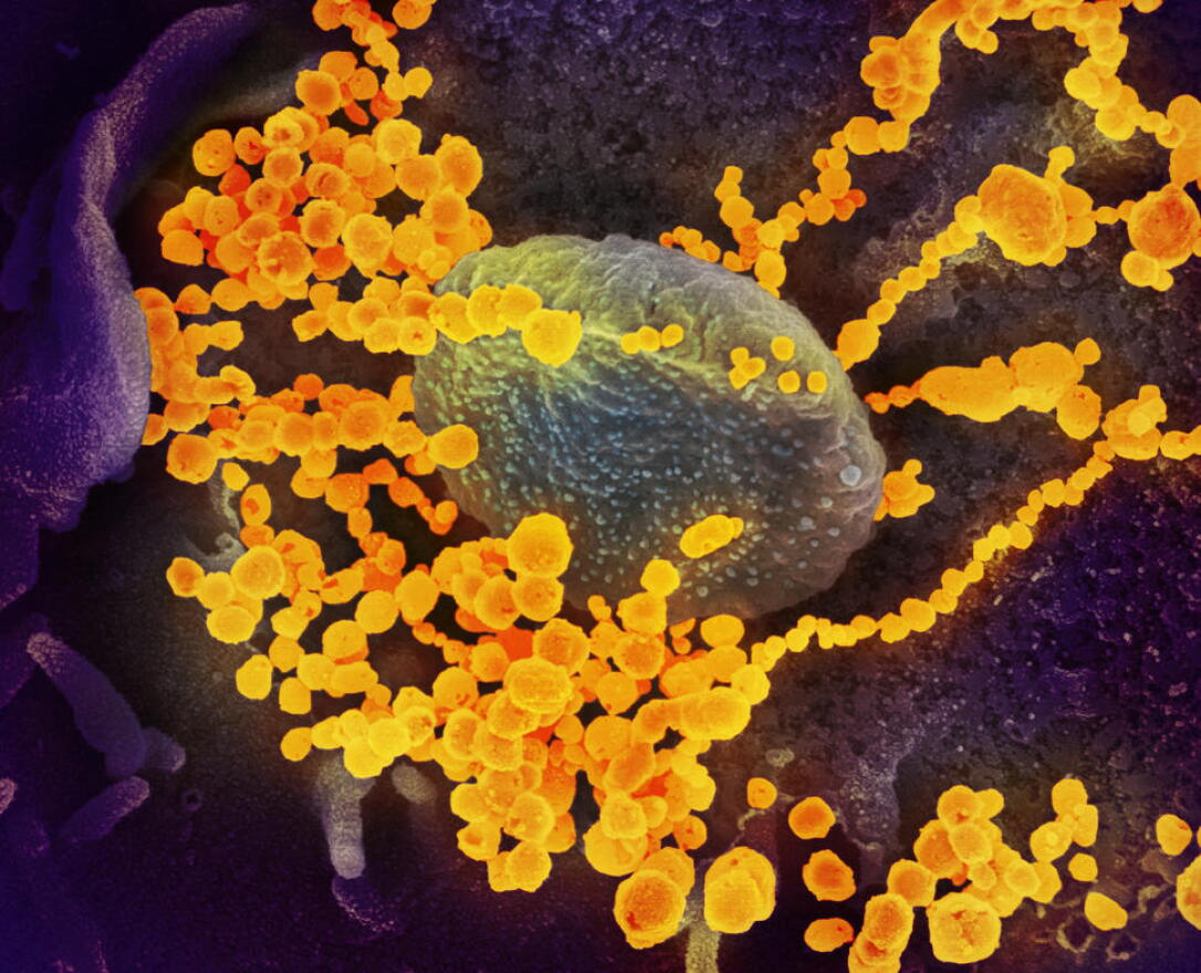 More than half the residents at the Elm Manor Nursing and Rehabilitation Center in Brighton have tested positive for the novel coronavirus, shown here emerging from the surface of cells cultured in the lab.